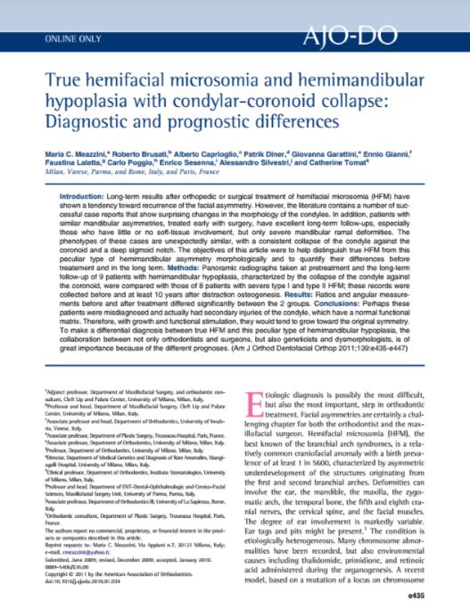 True hemifacial microsomia and hemimandibular hypoplasia with condylar-coronoid collapse