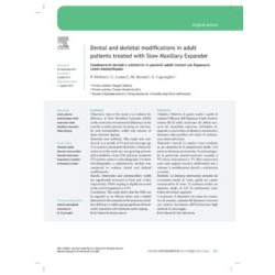 Dental and skeletal modifi cations in adult patients treated with Slow Maxillary Expander