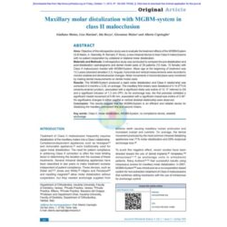 Maxillary molar distalization with MGBM‐system in  class II malocclusion