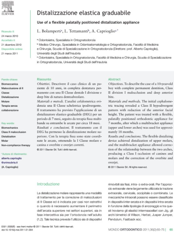 Bolamperti L. et al. - Mondo Ortodontico 2-2011 - Distalizzazione elestica graduabile