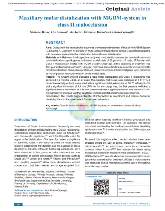 Maxillary molar distalization with MGBM‐system in class II malocclusion