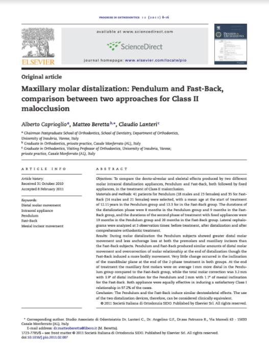 Maxillary molar distalization