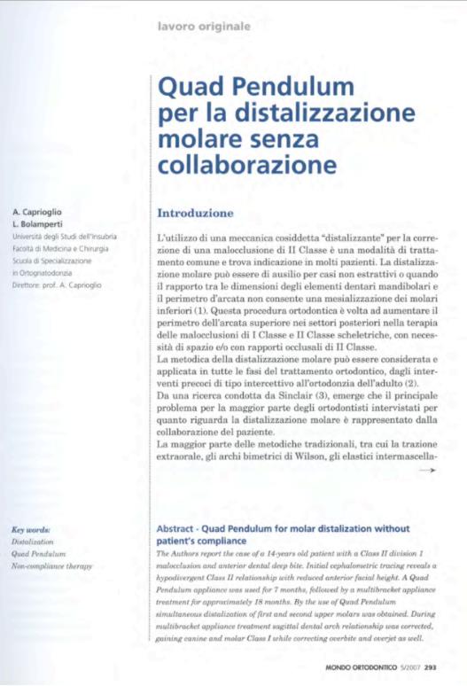 Quad Pendulum per la distalizzazione molare senza collaborazione