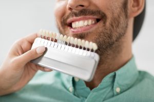 Scelta del colore in protesi dentaria clinica dentale caprioglio pavia