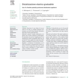 Distalizzazione elastica graduabile